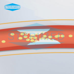 foley-balloon-catheter